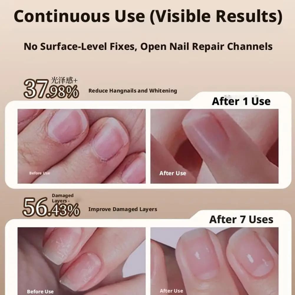 Penna Olio Cuticole 3-in-1 con Spingicuticole in Ceramica per Unghie Danneggiate e Secche - Penna per la Cura delle Unghie per Riparazione e Nutrimento
