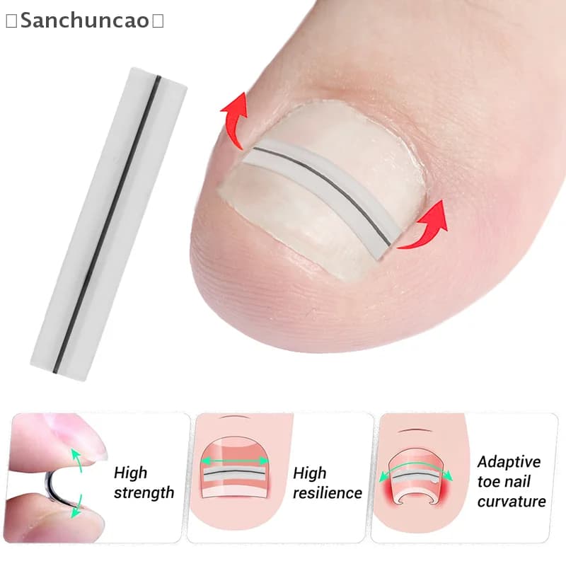 Strumento per la correzione dell'unghia del piede incarnita Raddrizzamento Clip Brace Trattamento delle unghie dei piedi incarnite Adesivo patch elastico Strumento per pedicure