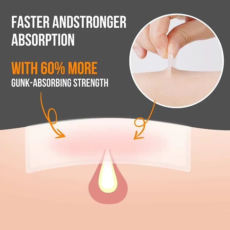 30 PZ/SET Brufolo Patch Acne Removal Acne Invisible Skin Care Corrector Face Macchia Absorbent Beauty Cosmetic Healing