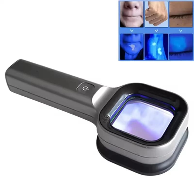 Lampada per legni Analizzatore della pelle Pelle Lente d'ingrandimento UV Test della pelle Uso domestico Test del viso Luce del legno Analisi del viso Rilevamento Cura della bellezza