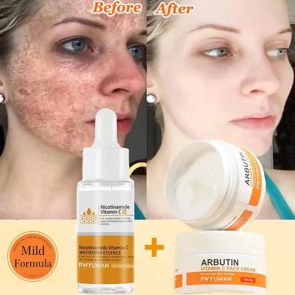 Removing dark spots Whitening Face Set Lentiggine Melanin Corrector Reducing thin lines Light the essence Korean Beauty Skin Care