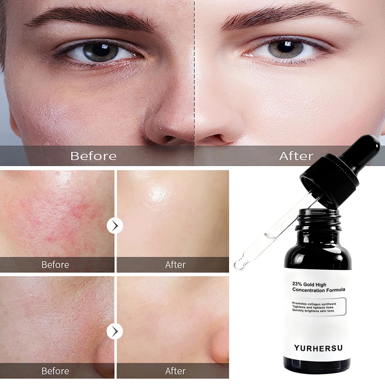 Siero Viso con 23% di Vitamina C, Soluzione Antiossidante Rassodante e Idratante per Tutti i Tipi di Pelle