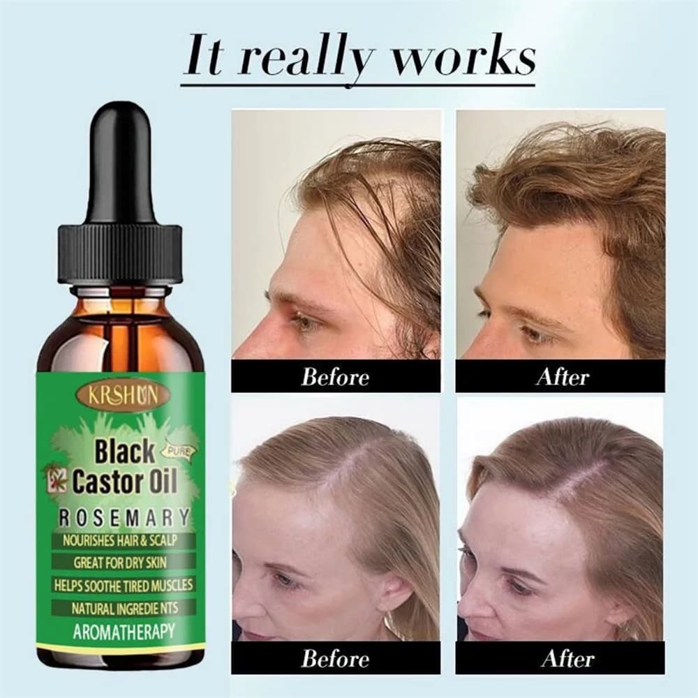 L'olio di ricino nero nutre la crescita dei capelli Massaggio della pelle Olio essenziale La crescita delle sopracciglia previene l'invecchiamento della pelle Prodotti per la cura dei capelli