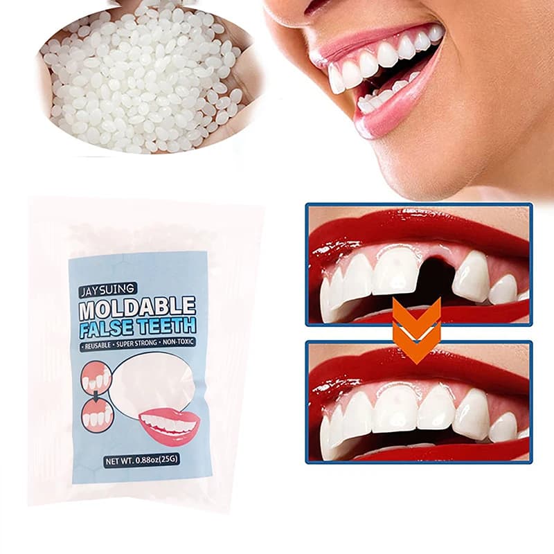 Resina 25g Kit di riparazione temporanea dei denti Denti e spazi vuoti Denti finti Colla solida Protesi adesiva Sbiancamento dei denti Bellezza dei denti