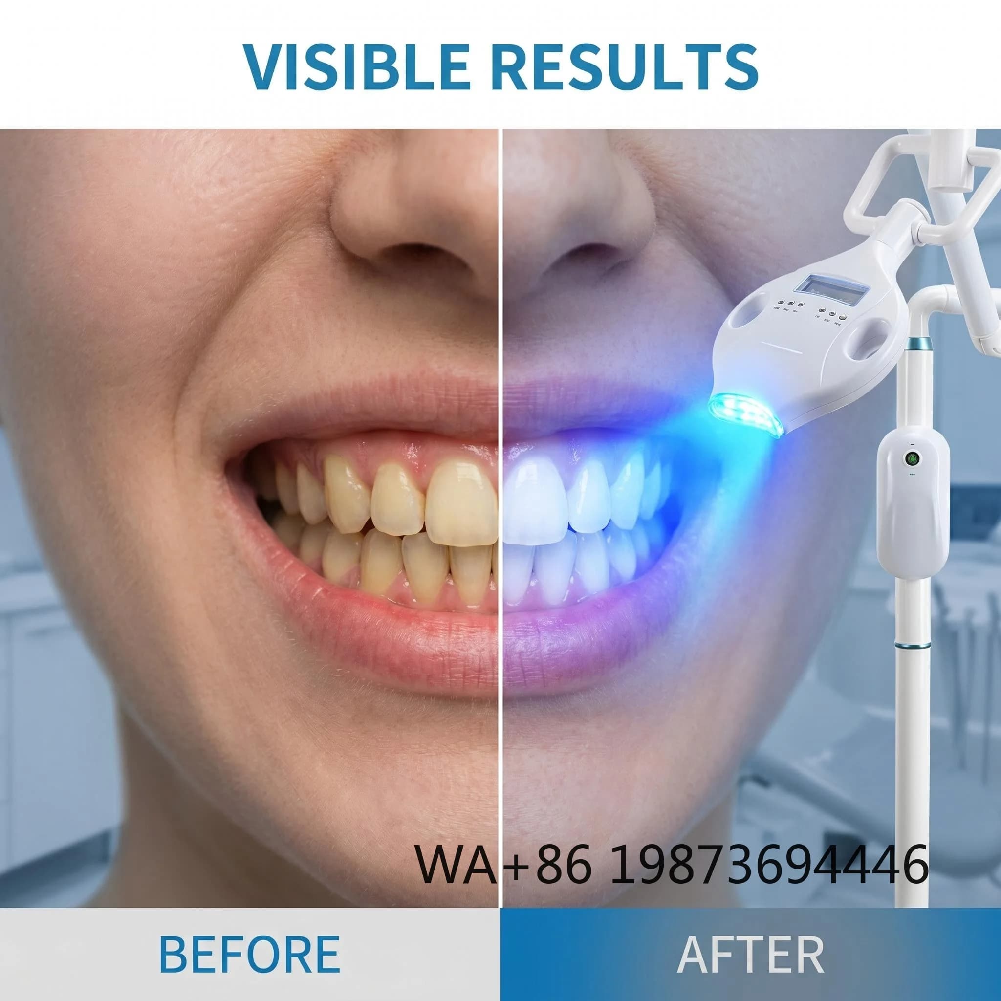 40W LED Dental Whitening Professional Accelerator Lamp, High Power Whitening Device