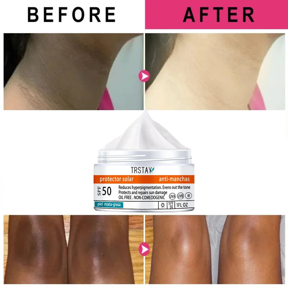 TRSTAY solar protection reduces pigmentation The uniform skin tone protects and repairs body cream damaged by the sun for the care of the skin of mothers and children
