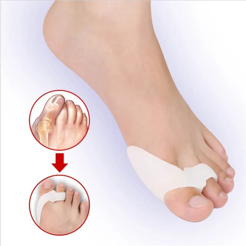 1/2 paia di dita del piede in gel di silicone Separatore della punta a due fori Protezione del pollice Valgo Regolatore dell'alluce valgo Protezione per la cura dei piedi