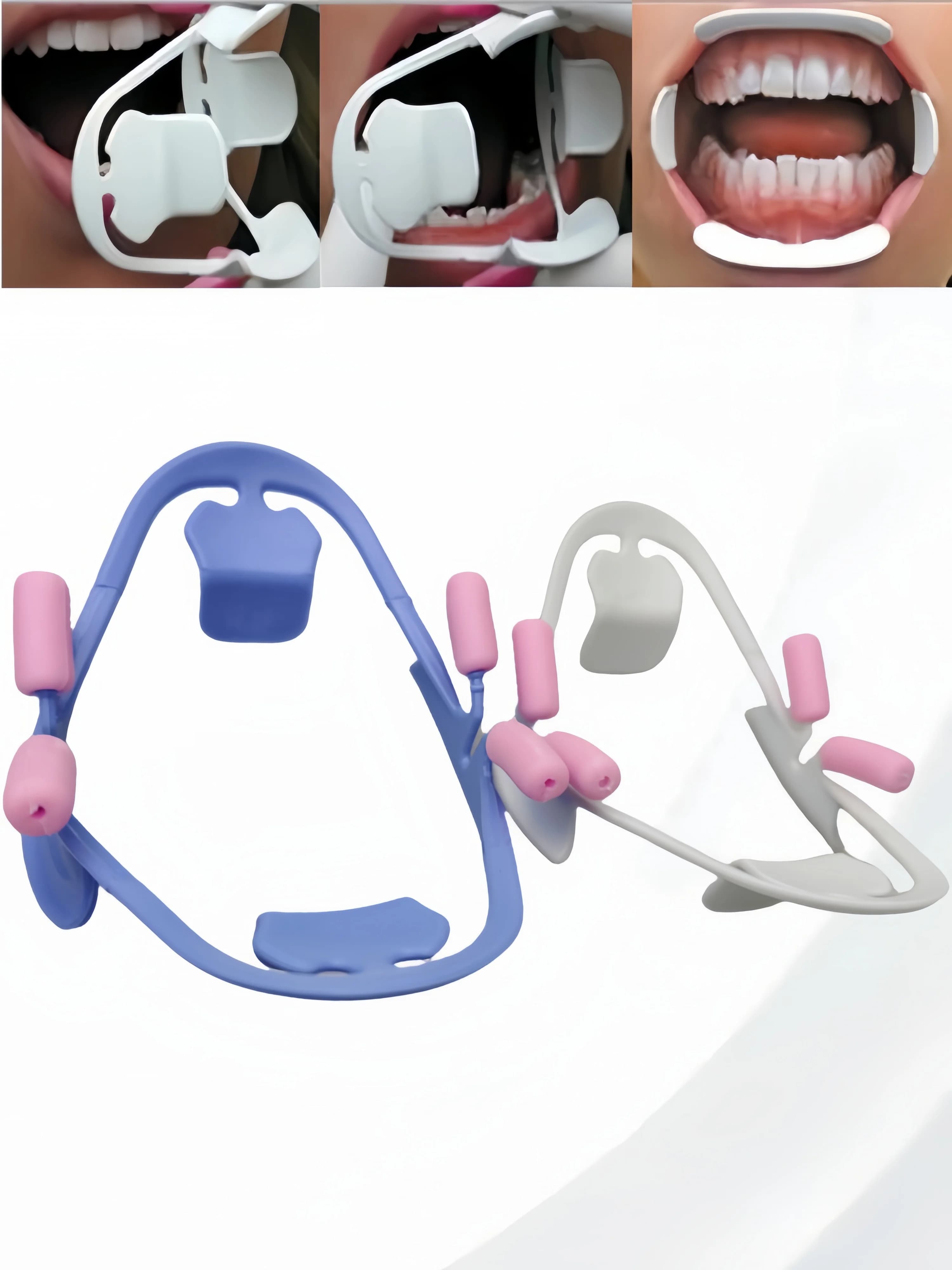 ** Divaricatore per guance dentale 3D - Apri bocca per sbiancamento dei denti a forma di O con divaricatore per labbra per pulizia ortodontica e professionale
