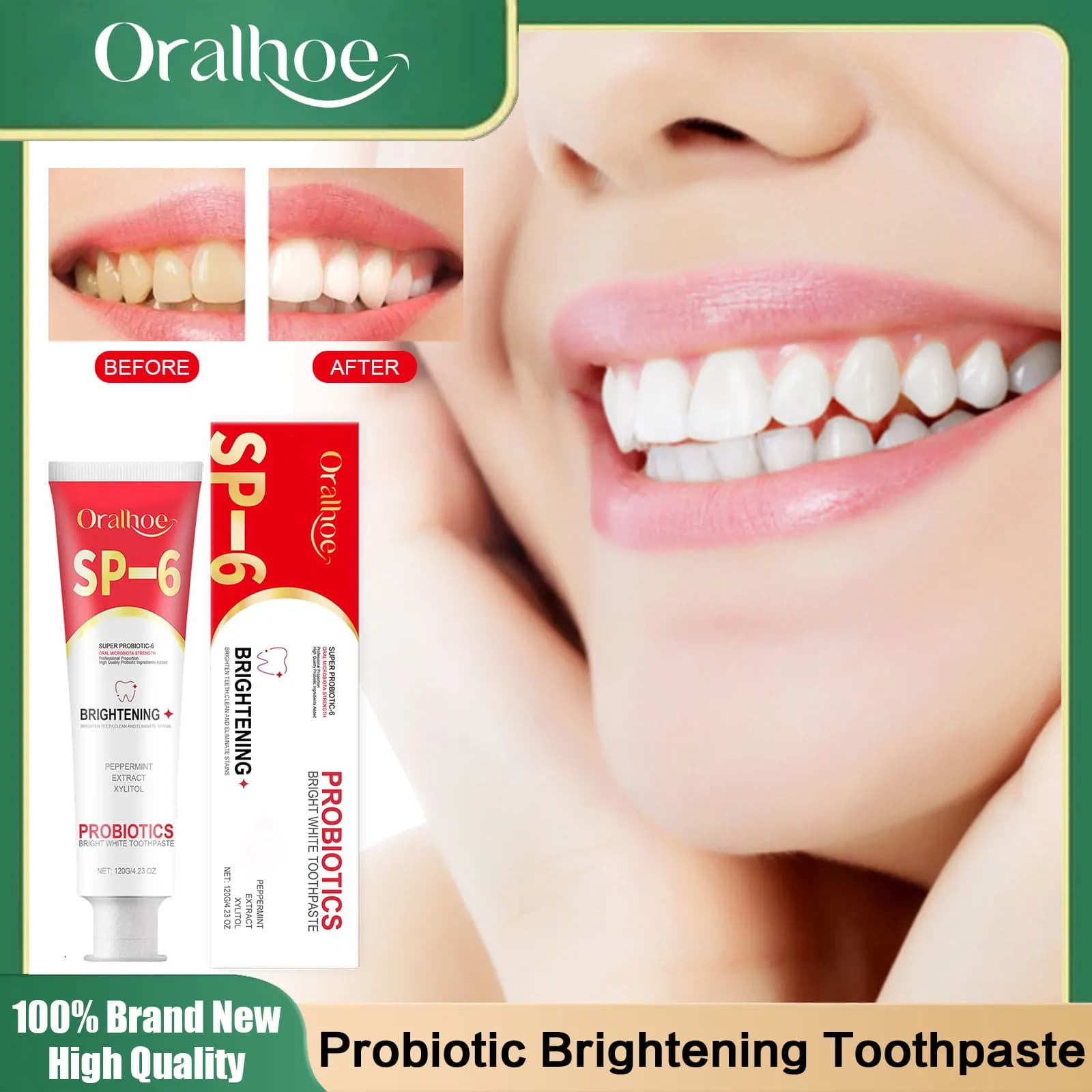 Sp 6 Probiotic toothpaste Dental stone removal Improve yellow tooth Remove stains Prevent periodontitis Products for teeth whitening