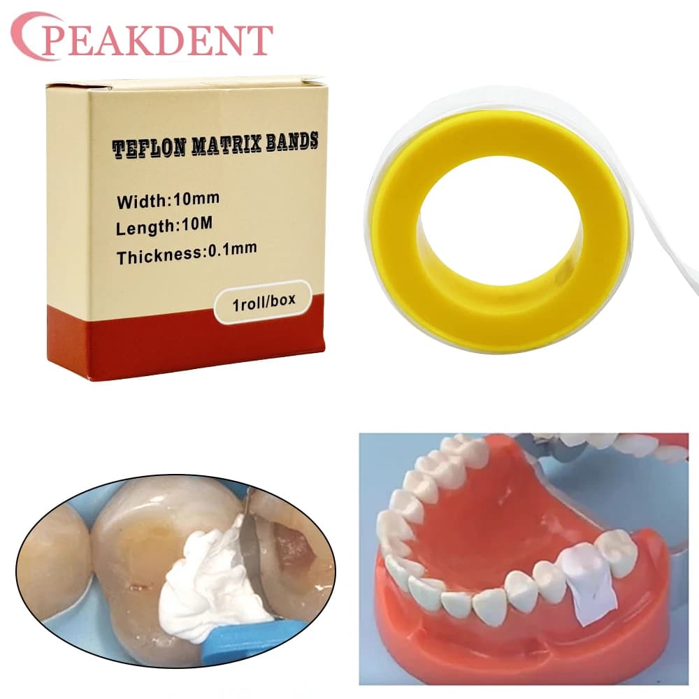 1 Rotolo di Strisce Matriciali Dentali in Teflon, Anti-Corrosione, Antiaderenti, Materiale PTFE per Ripristini Dentali