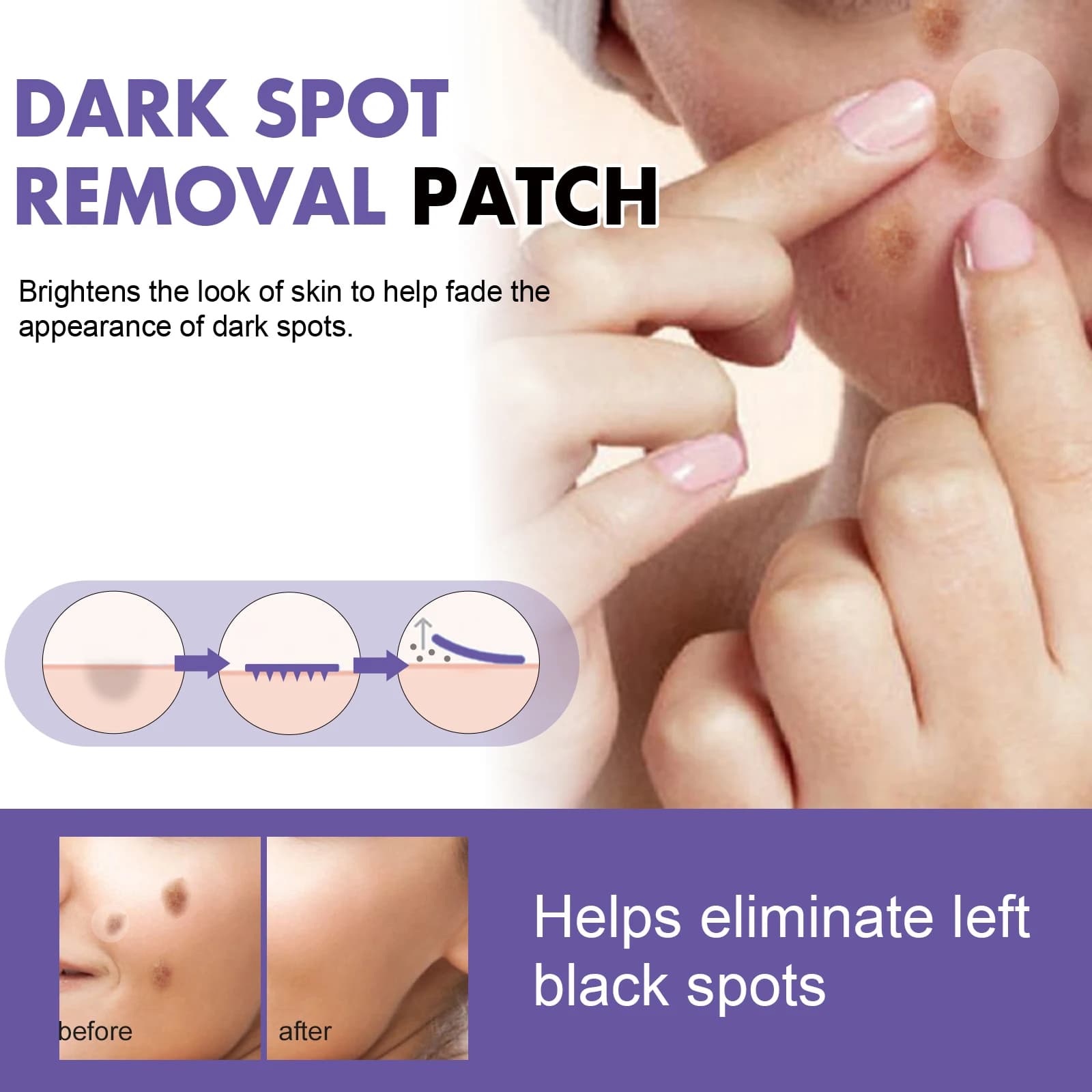 Spot-Removing Patches, Face Dark Spot Corrector for Melasma Pigmentation, Brightening Moisturizing Skin Care Treatment