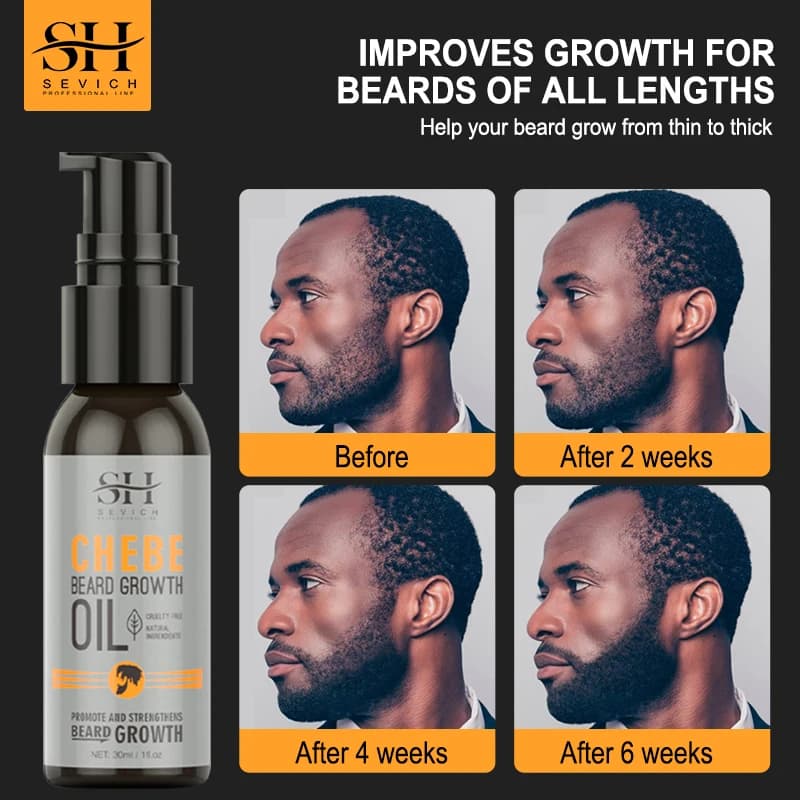 Sevich Men Beard Growth Essential Chebe Fast Beard Growth Enhancer prodotti professionali per il trattamento della perdita dei capelli siero per la cura della barba