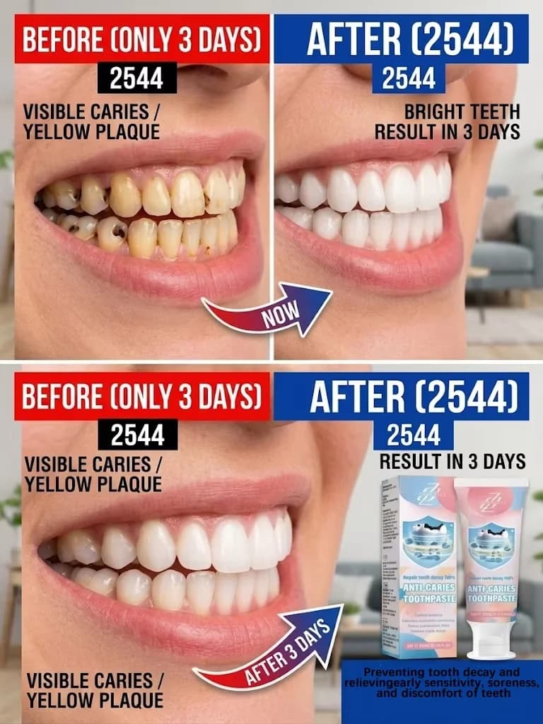 1 dentifricio anti-carie, disintegra in profondità le macchie ostinate di fumo e tè, il tartaro nero e giallo da 10 anni, sbianca e illumina i denti senza danneggiare lo smalto, elimina l'alito cattivo e lascia una fragranza di menta. Spazzola il pelo mattina e sera