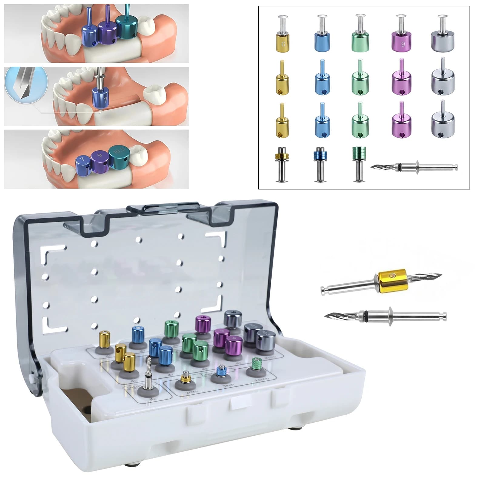 Set di 19 Pezzi per Foratura Completamente Guidata, Kit Universale per Guida e Posizionamento Impianti Dentali, Strumento per Dentisti