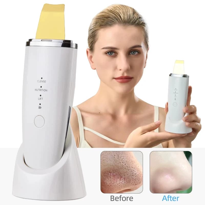 Professional ultrasound for face skin Scrubber Vibration Face spatula Removal of comedone Pala Clean Cavitation Peeling Machine