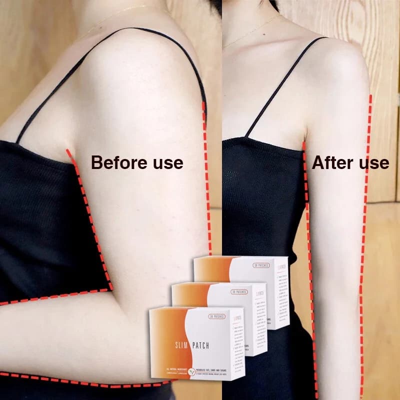 10 DAYS Slimming Patch Detox Weight Loss Sticker Navel Belly Stick Quick Slim Patch Fat Burning Thin Body Belly Fat Burner