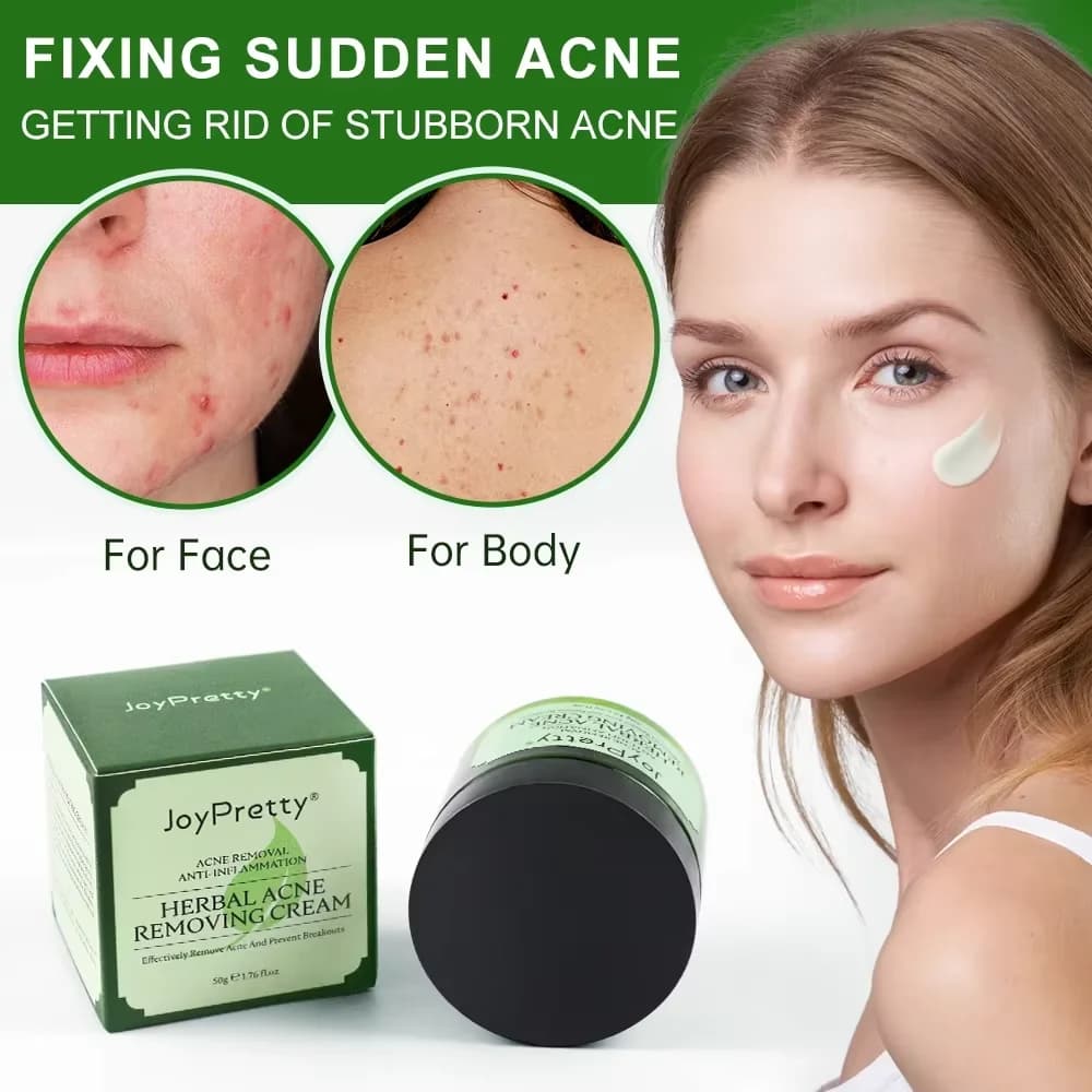 JoyPrettyin Herbal Acne Face Cream Removal of Brufoli Signs Oil Control Moisturizing Pockmark Creams for Smooth Face Product for Skin Care