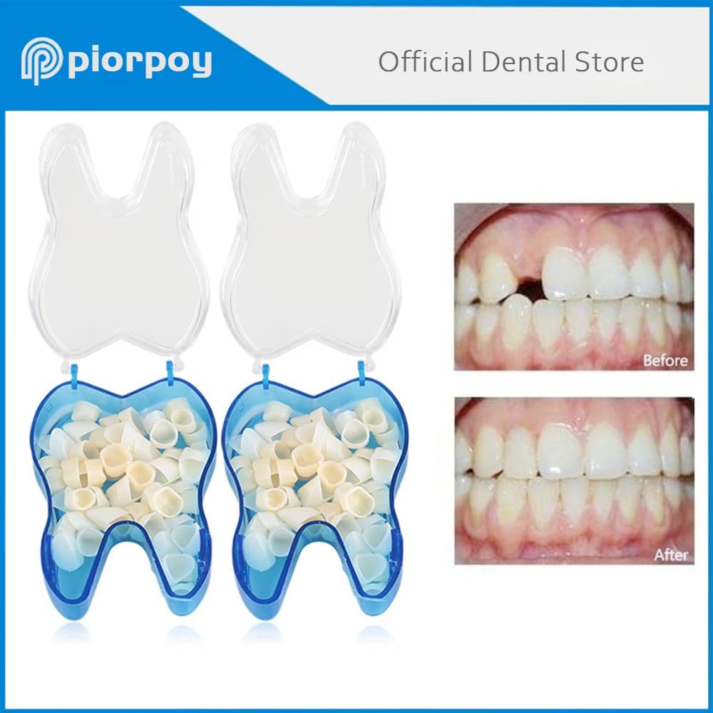 PIORPOY Set di 50/70 Pezzi di Faccette Dentali Temporanee, Corona Temporanea in Resina Sbiancante per Molari e Anteriori, Strumenti Dentali in Porcellana