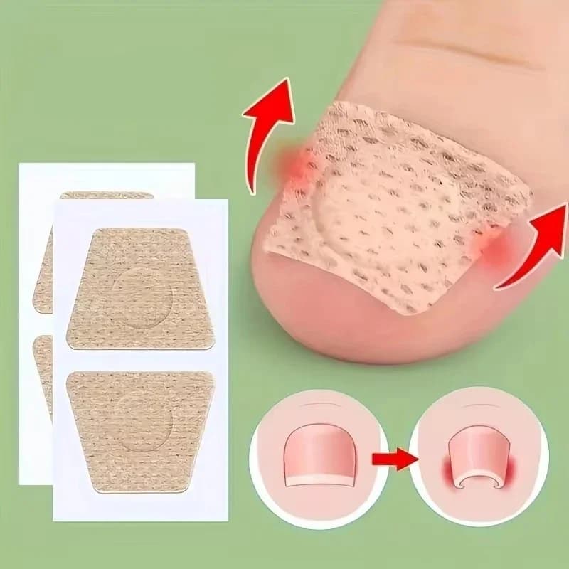 Patch for Nail Repair Gray Fungal Nails Inspection Soft treatment of the Paronychia Adhesive for the Correction of the Incarnied Foot Nail Care