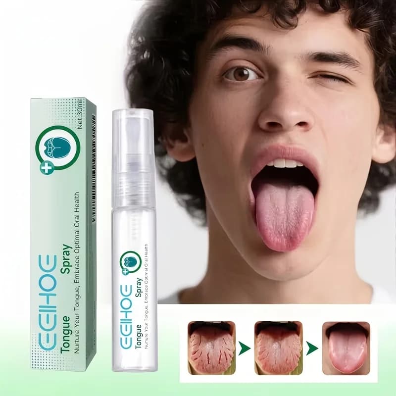 Spray per la Lingua Portatile - Menta e Limone per Alito Fresco, Idrata la Lingua Secca, Cura Orale Quotidiana e Spray per Igiene Orale da Viaggio
