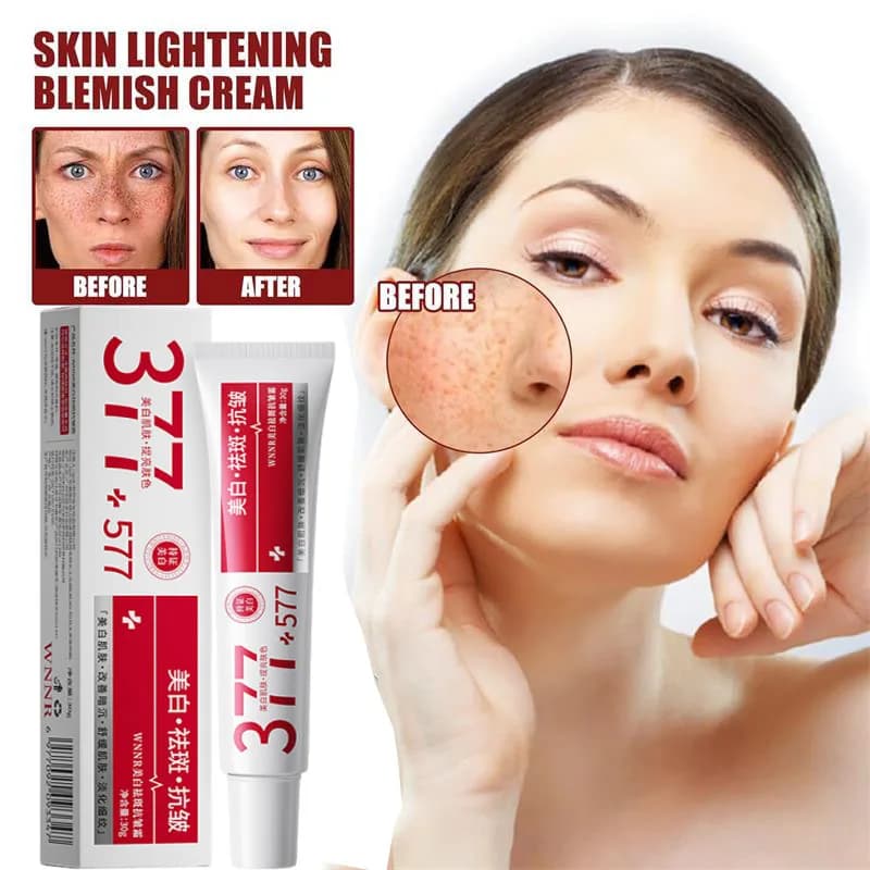 Potente Crema Sbiancante Rimuovi-Macchie, Illumina Rapidamente la Pelle, Elimina la Melanina, Pigmentazione, Melasma e Macchie Scure, Cura della Pelle Coreana per il Viso