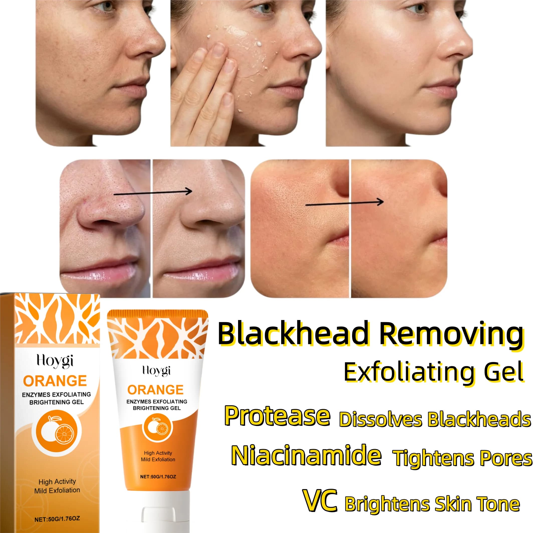 Gel esfoliante per punti neri con proteasi e niacinamide, purifica i pori e illumina il tono della pelle, acido ascorbico, delicato rimuovi cellule morte.