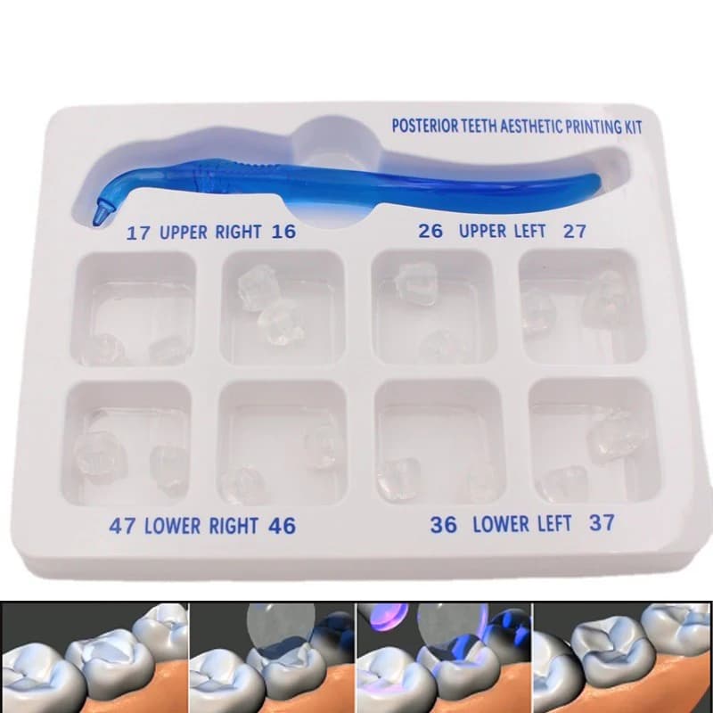 Kit di Stampa Estetica per Denti Posteriori, Strumenti per Compositi Fotopolimerizzabili, Set per Impronte Orali e Modellazione in Odontoiatria
