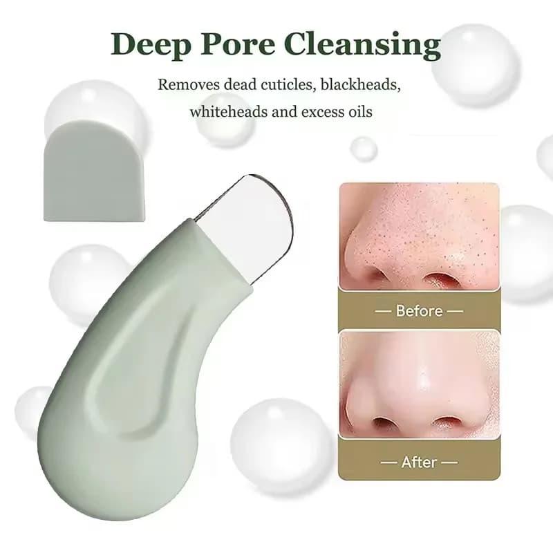 Blackhead and Whitehead Removal Tool for Nose and Face - Skin Pore Cleaner Skin Care Tools for Women