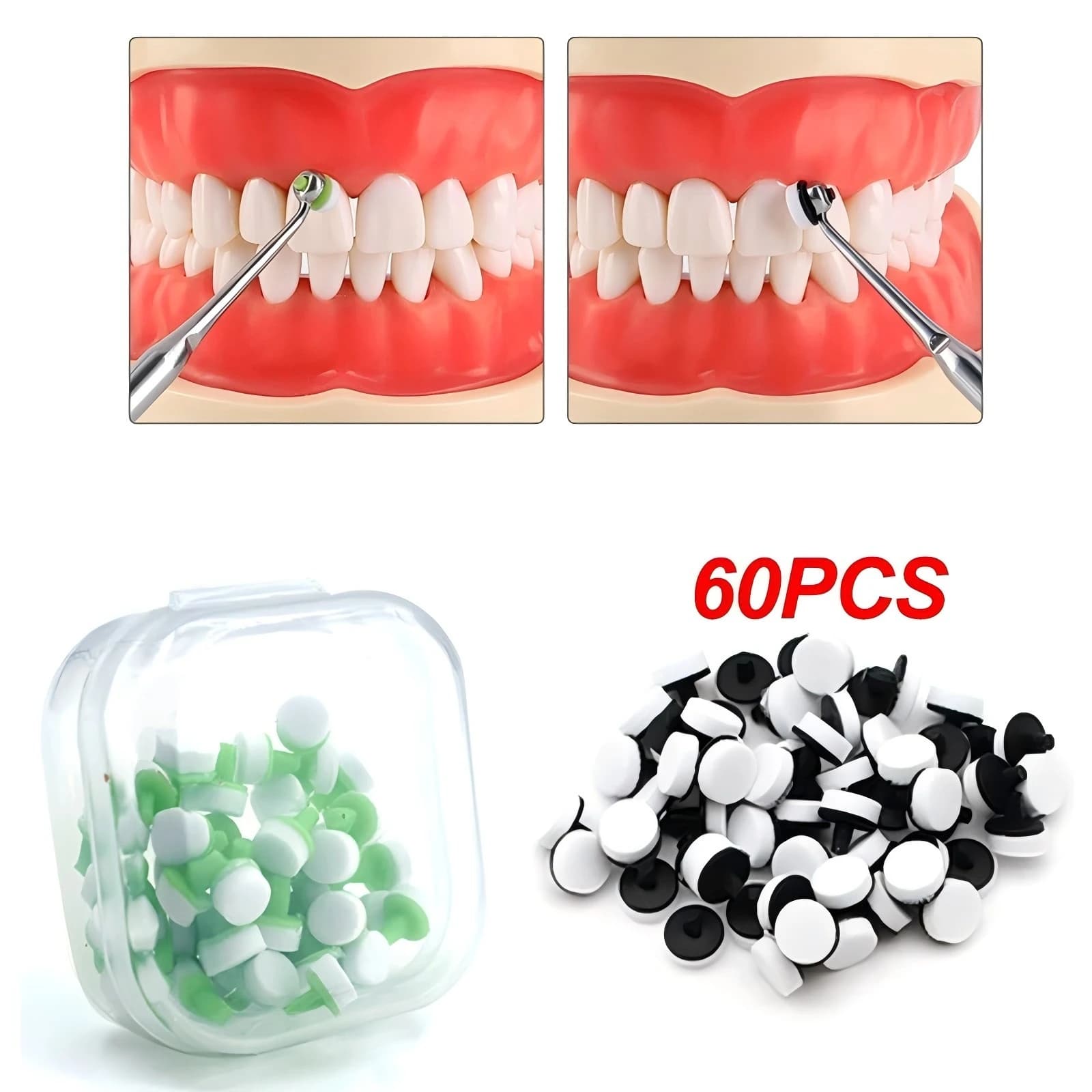 60 Pieces/Box Instruments for Dental Resin Modeling, Foam Bearings for Veneer, Composite Resin Tools and Materials, Dental Whitening Tool