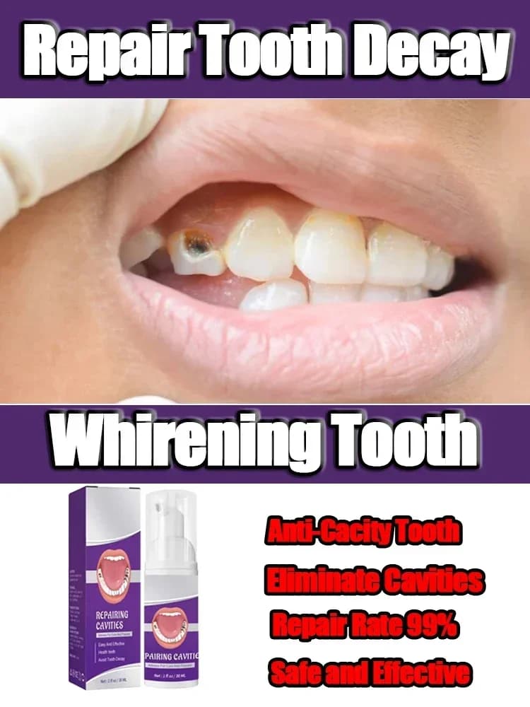 Efficacy Teeth whitening Repair tooth caries Calculation Plaque Periodntitis Remove cavities