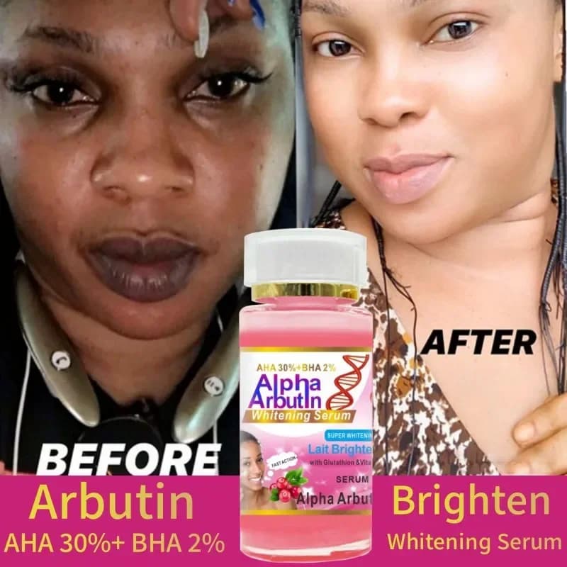 120ml SUPER AHA 30%+BHA2% Alpha Arbutin X 3 Face Serum Milk Scratch with glutathione and vitamins C Cream