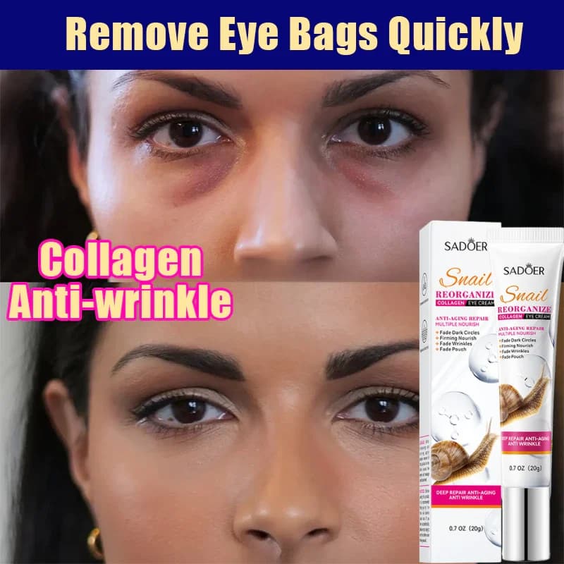Remove Eye Bags Eye Cream Snail Collagen Anti Eyewear Anti-wrinkles Hydrating Shaping Beauty Eyes Skin Care Products