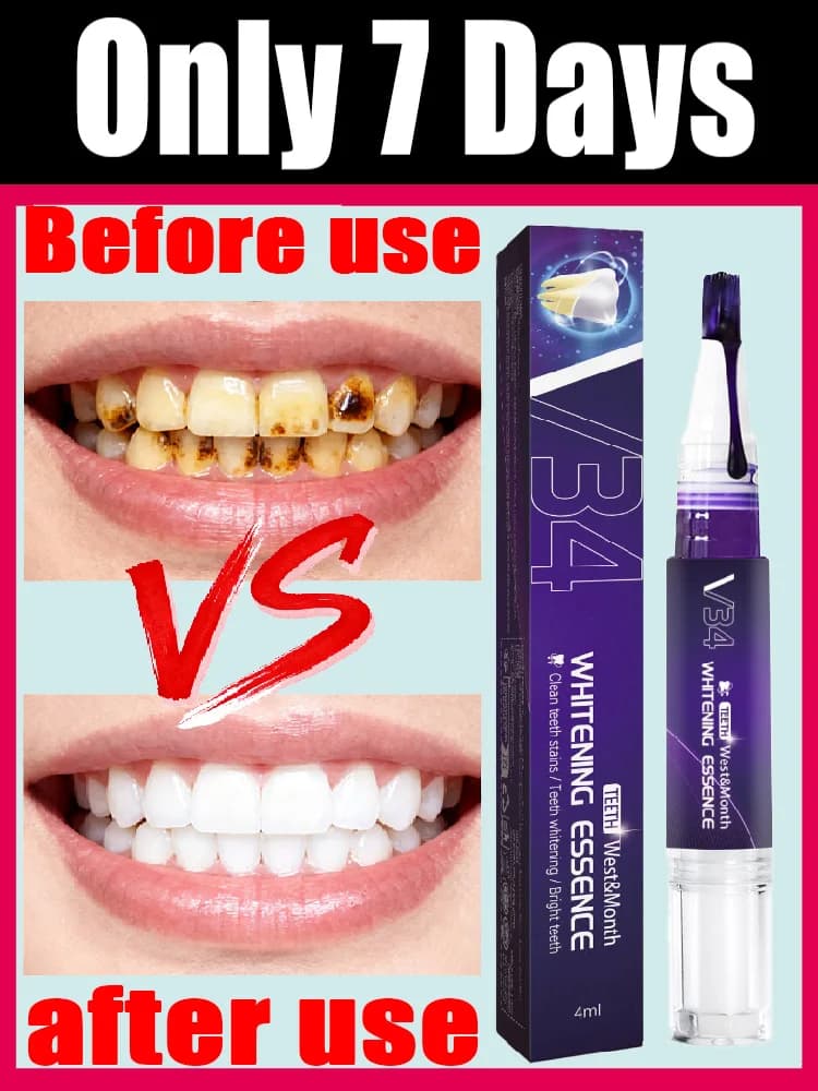 Purple dental cleaning pen, teeth cleaning, yellow teeth, tobacco teeth, tartar, fresh breath, oral hygiene