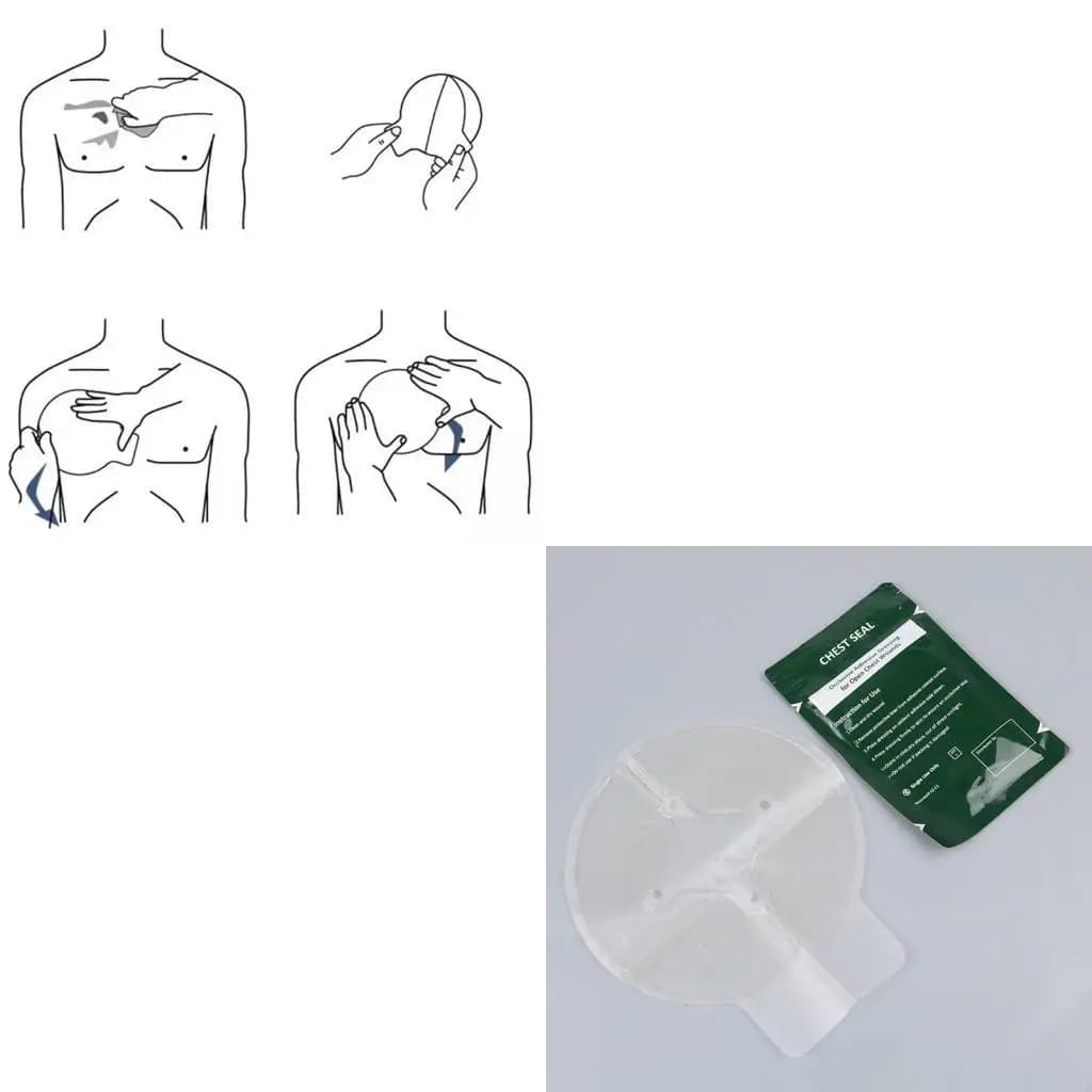 Bende per medicazioni ventilate con sigillo medico per il torace Strumento esterno Adesivo per traumi emergenza per ferite