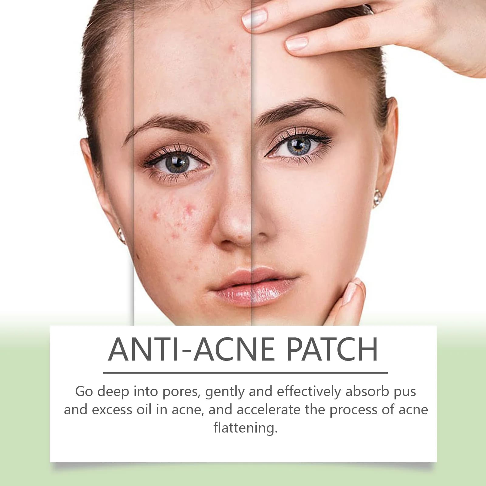 Cerotti Idrocolloidali per Acne che Assorbono il Puntello e Ripristinano la Pelle Perfetta, Trattamento Invisibile per Imperfezioni Facciali