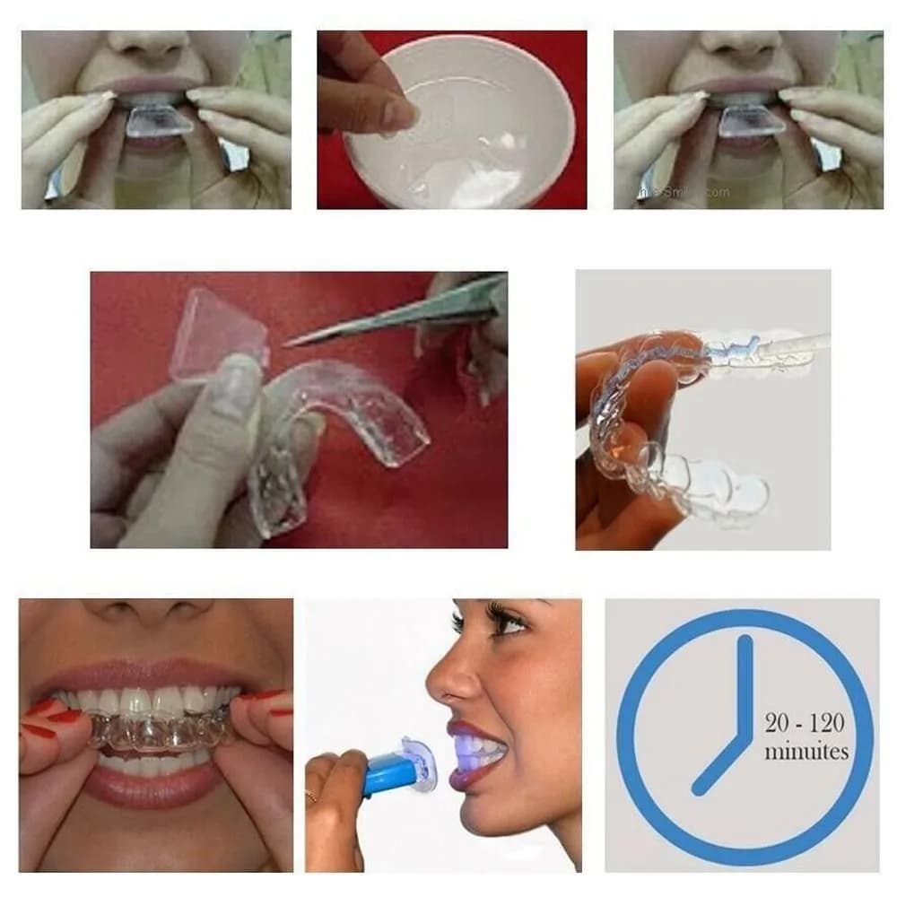 Removable Silicone Night Parade, Genital Protection, Tooth Whitening Parade, Thermoformable, Tooth Care, Against Lock and Cooling
