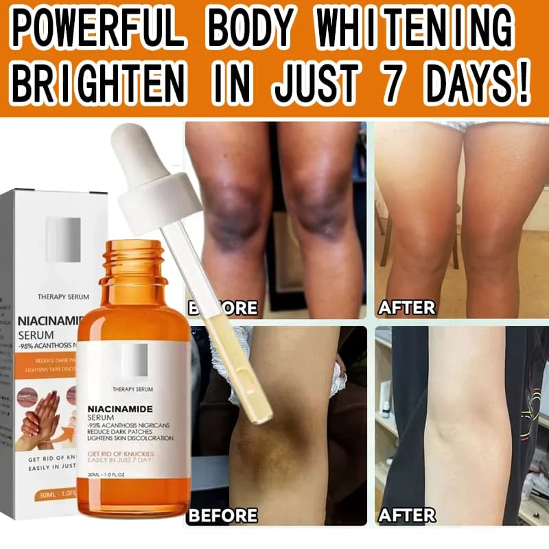 Whitening serum for dark knuckles Elbows Serum beach Illumina private part Skin removal Intime Macchie dark Melanina