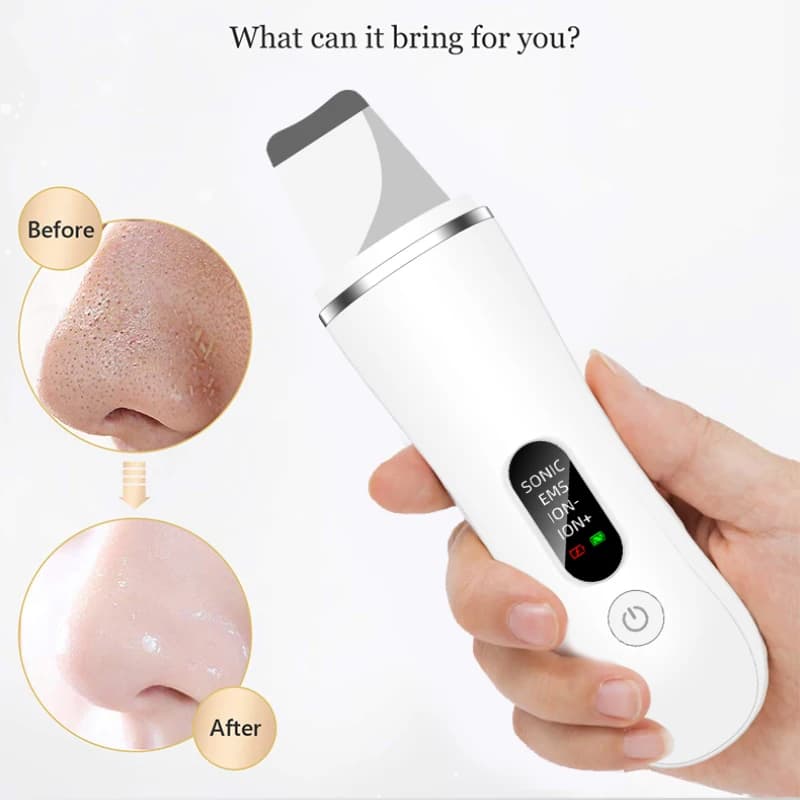 Nuovo Scrubber ad ultrasuoni per la pelle Pulizia profonda del viso Punti neri Rimuovi pulizia ad ultrasuoni Cavitazione Peeling Pala Scrubber per la pelle