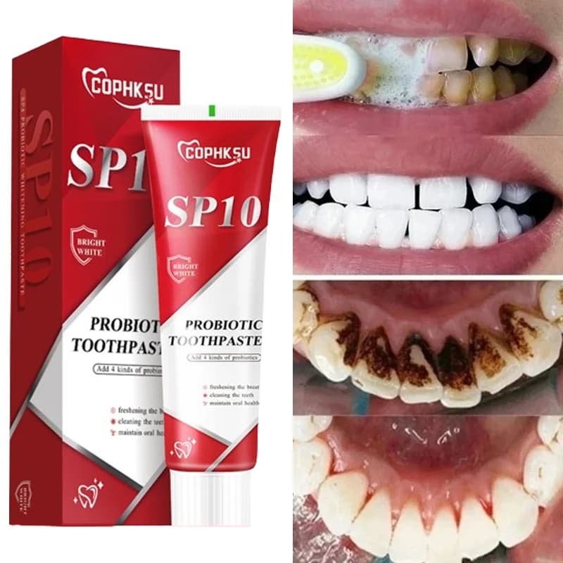 SP-10 Probiotic toothpaste Teeth whitening Remove plaque stains Teeth whitening Oral hygiene Clean Fresh breath Teeth care products