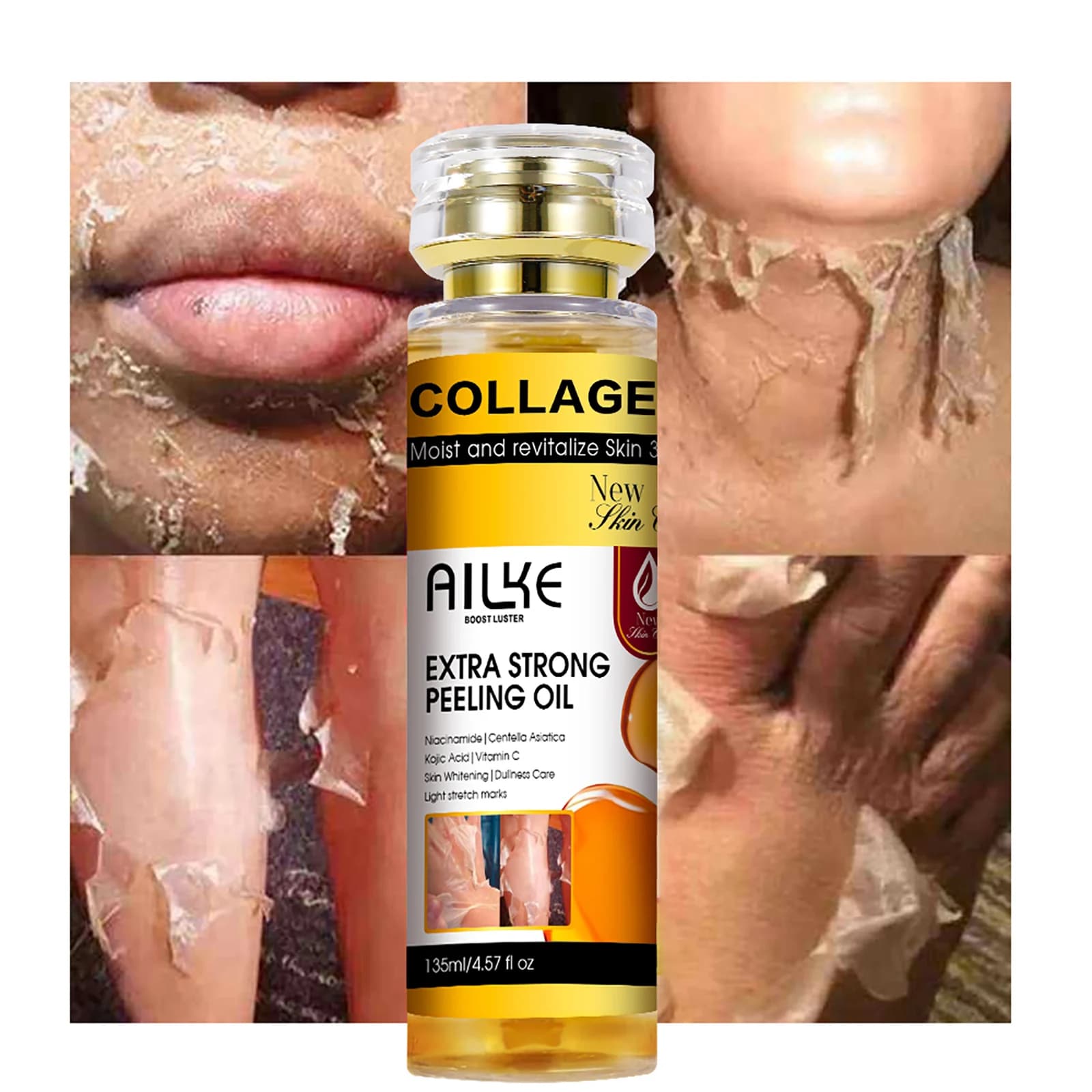 AILKE Yellow collagen peeling oil for all skin types, removing stretch marks, clearing, improves rough skin, gentle exfoliation