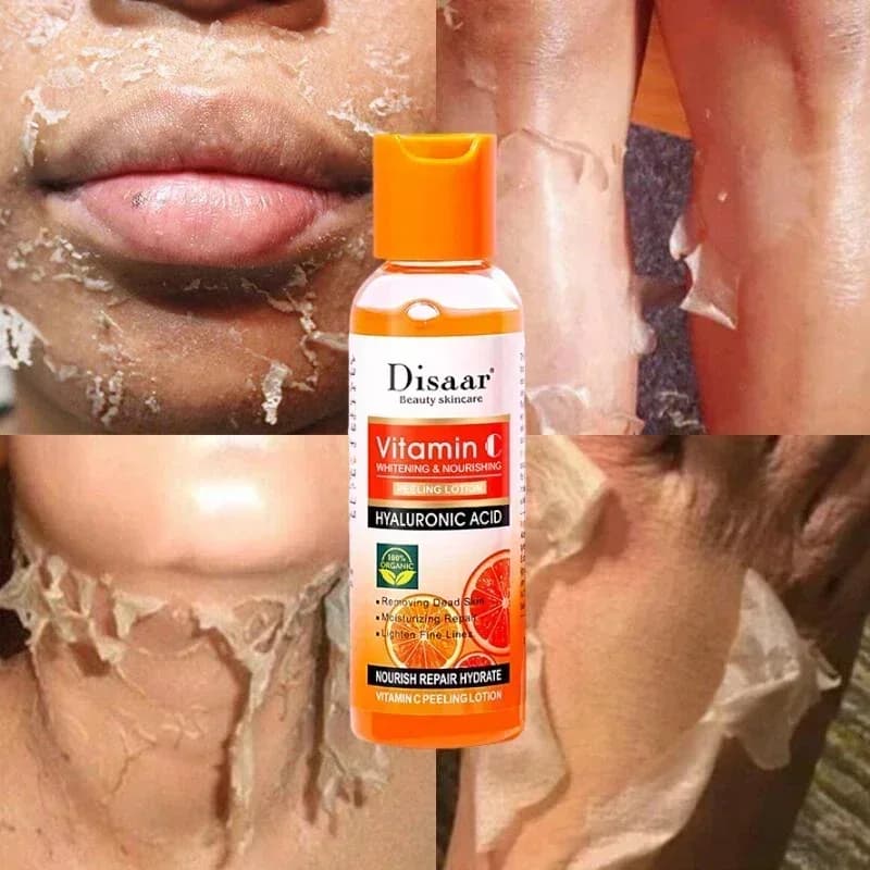 Lozione peeling gialla Olio 100% biologico Sbiancante Pelle scura Esfoliante Sbiancante Nutriente Acido ialuronico Scrub corpo idratante