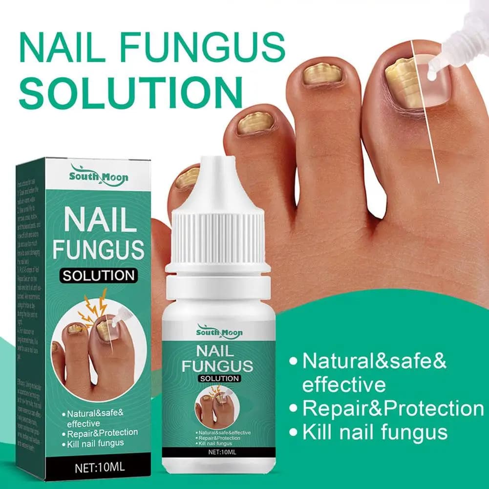 Siero per il trattamento della funzione fungina delle unghie (10ml) Olio essenziale curativo e riparatore, Gel anti-infezione per i piedi, Crema per la rimozione della funzione fungina delle unghie