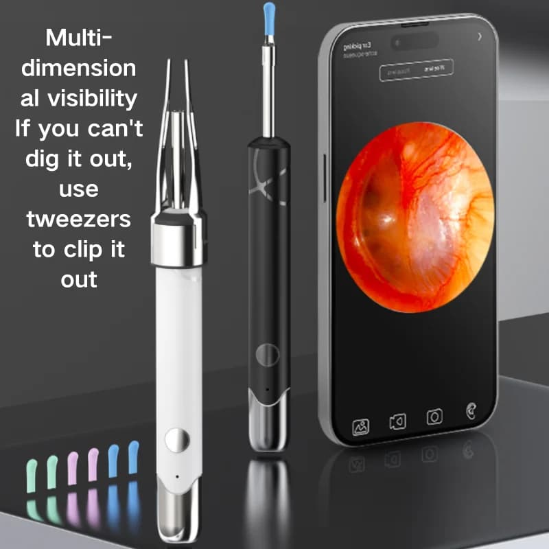 New visual tool for cleaning ears with tweezers, compatible with Android and Apple smartphones, also suitable for pets
