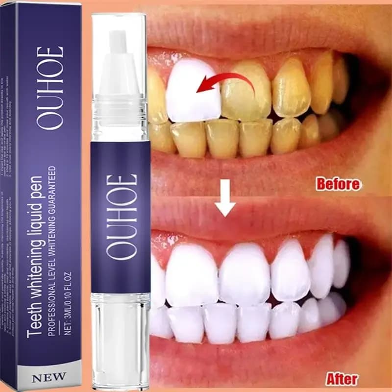 Toothpaste Pen for Toothpaste Remove Plaque Spots Cleaning Oral Hygiene Whitening Dental Tools Fresh Food Teeth Care