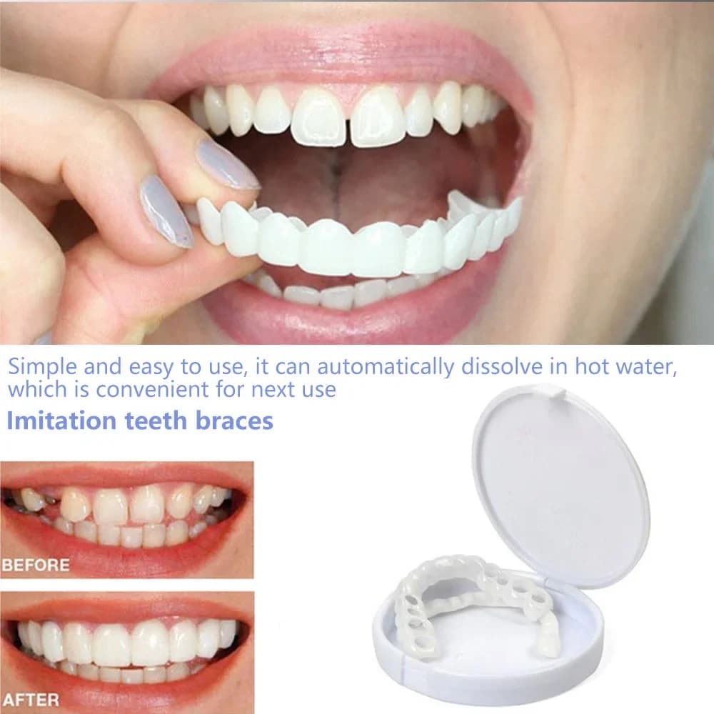 Sdottor Faux teeth Artificial braces Teeth whitening Snap On Silicone smile veneers Upper and lower teeth Brace Cover Dental Beau