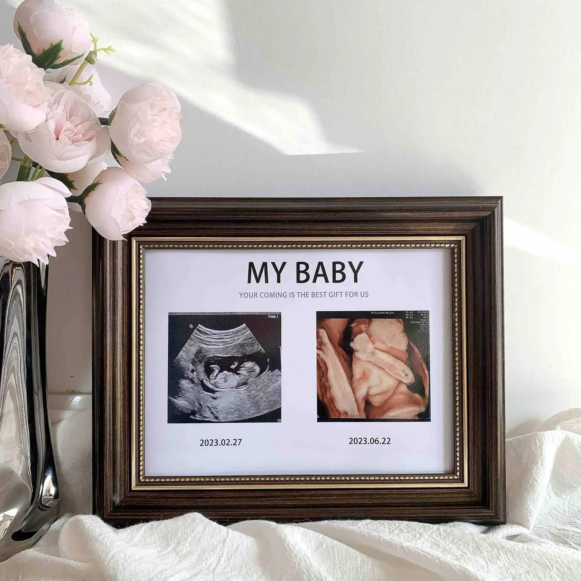 Cornice Portafoto Moderna in Resina per Ecografia 4D del Bambino, Stampa Immagini, Regalo per Donne in Gravidanza, Decorazione da Tavolo per Nascita