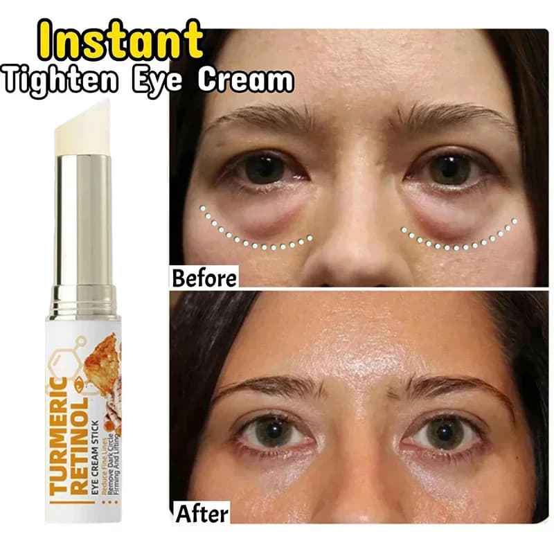 Instant Eye Bag Remove Eye Cream Anti-Government Parts Dark circles Inflorescence Dissolvency Slender Lines Lift Enlighten Korean Beauty Eye Care