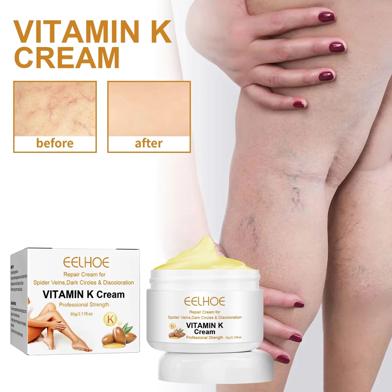 EELHOE Crema alla vitamina K per le gambe - Raffreddamento delle vene varicose Cura Lenitiva Sollievo Gonfiore Dolore muscolare Massaggio Idratante Cura della pelle
