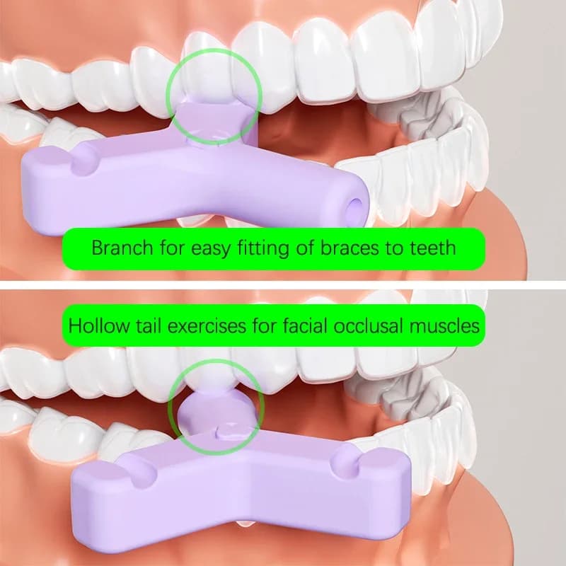 1/4PCS Dentale Chewies Denti In Silicone Bastone Dead Orthodontic Dead Chewies Prevent Y Shape Distortion