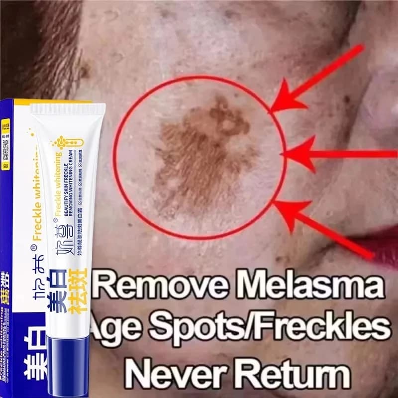 Powerful whitening cream for removal of spots Lighting skin Quickly eliminates pigmentation of melanin Melasma Dark Macchie Skin Care Korean face